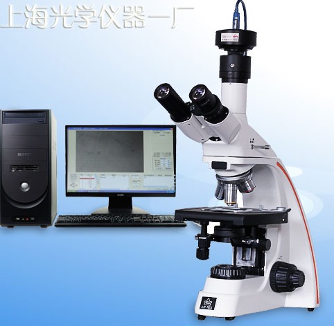 @΢۵ȼϵy(tng)YP-2r(ji)